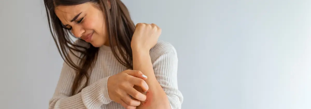 Orticaria allergica e dermatite da contatto sintomi, diagnosi e cure