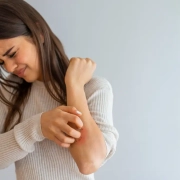 Orticaria allergica e dermatite da contatto sintomi, diagnosi e cure