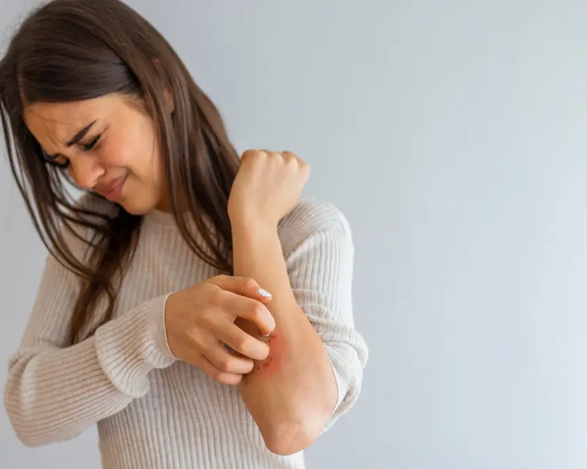 Orticaria allergica e dermatite da contatto sintomi, diagnosi e cure