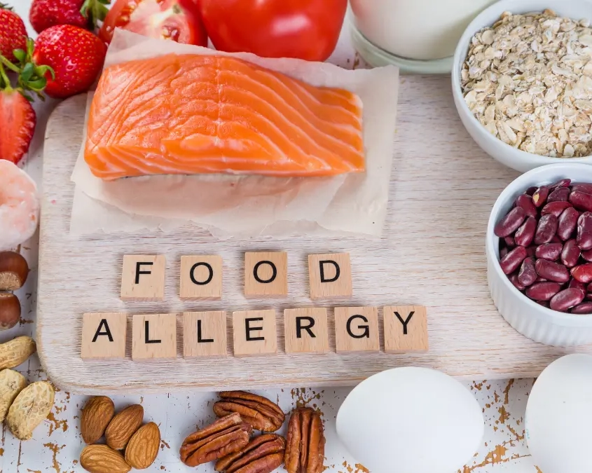 allergie-alimentari-sintomi-test-quando-specialista Allergie alimentari: come riconoscerle, quali test fare e quando rivolgersi allo specialista